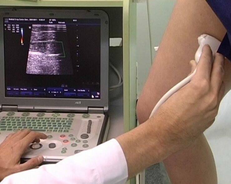 diagnóstico por ultrasonido de varices pélvicas