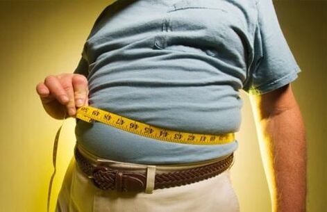 el exceso de peso provoca el desarrollo de venas varicosas